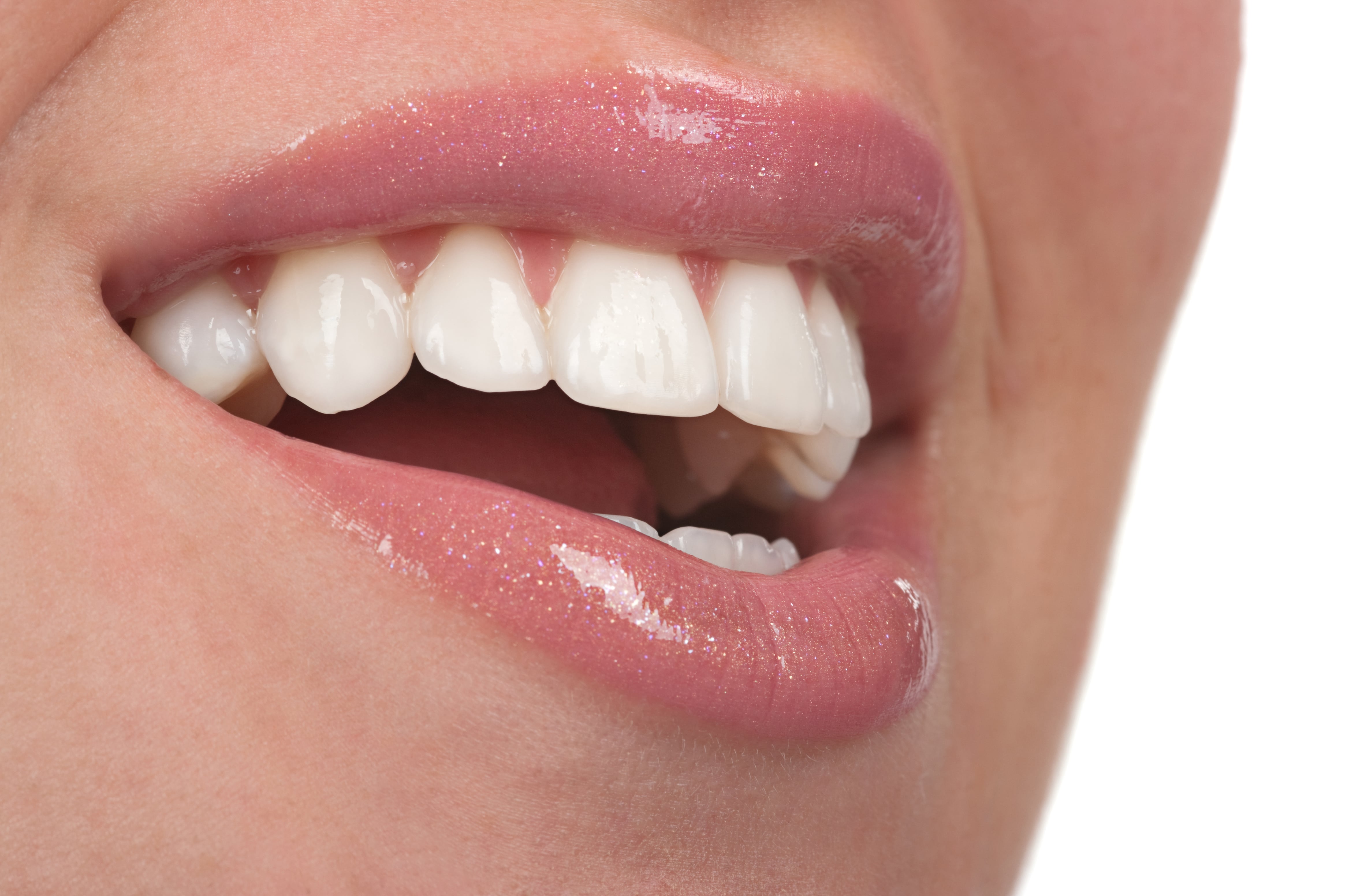 How Do Cosmetic Veneers Completely Alter A Smile Astoria Ny