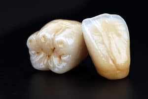 lifelike dental crown