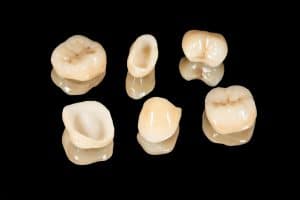 porcelain crowns