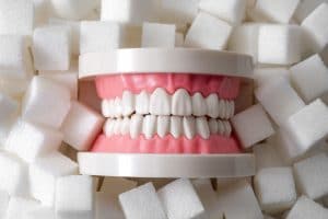 toothaches tooth decay