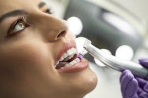 dental cleaning