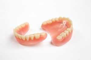 complete dentures