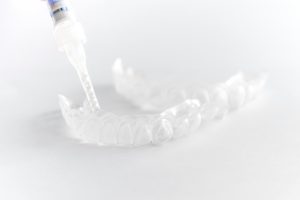 astoria teeth whitening