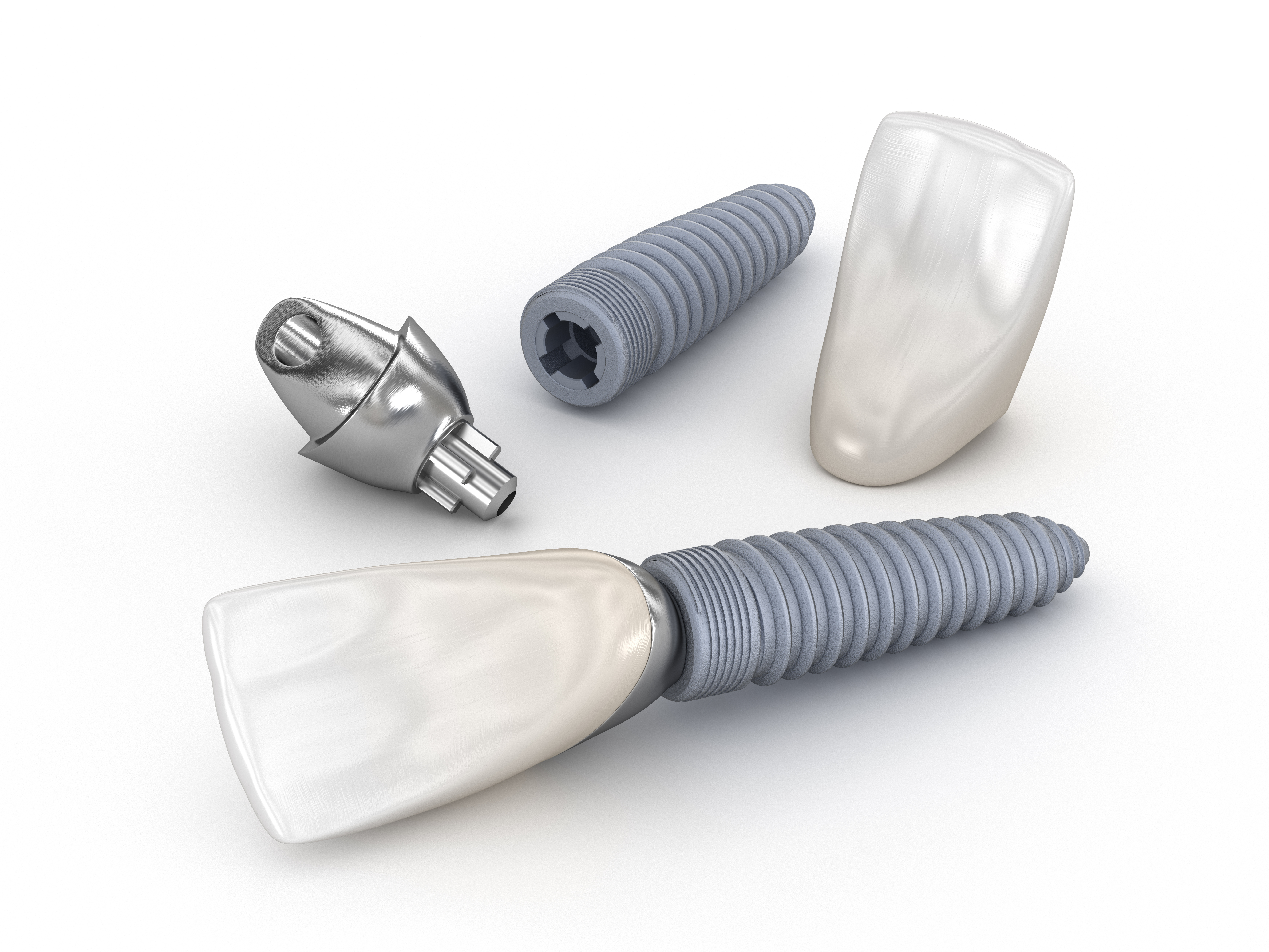 Los implantes dentales se pueden quitar