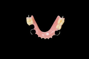astoria partial dentures