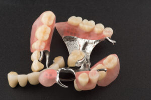 astoria partial denture