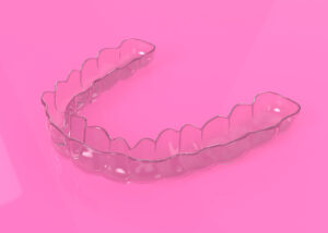 astoria clearcorrect aligners