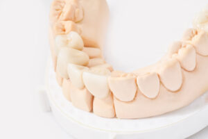 astoria dental crowns