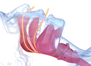 astoria sleep apnea