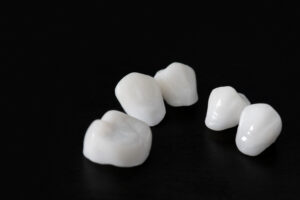 astoria dental crowns