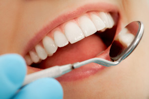 dentalfilling