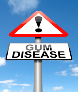 gum disease